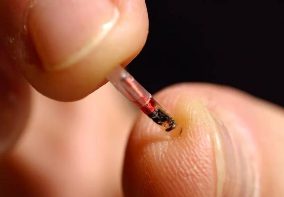 Thousands of Swedes Are Voluntarily Getting Microchipped