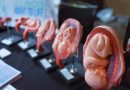 Abortion Leading Cause of Death in 2018 with 41 Million Killed