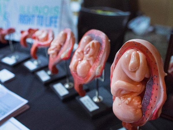 Abortion Leading Cause of Death in 2018 with 41 Million Killed