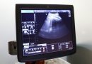 Kentucky Senate Passes Bill Banning Abortion when Baby’s Heartbeat First Detected