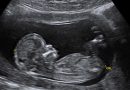 ‘A Historic Day’: Pro-Lifers Rejoice After Court Upholds Kentucky’s Landmark Ultrasound Law
