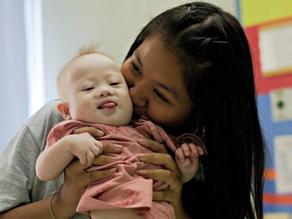 Selective Abortion of Down Syndrome Babies Rises in UK